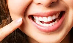La Glace | Laser Teeth Whitening Session for 1