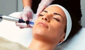 Luxuria Beauty Bar | Microneedling – Full face & Neck and Decolate for 1