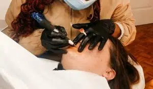 Luxuria Beauty Bar | Microneedling – Full face & Neck and Decolate for 1