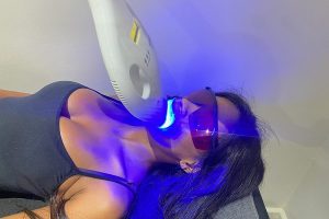 Refresche |  Teeth Whitening for 1