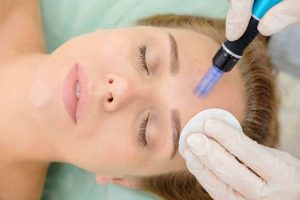 DH Aesthetics | Microneedling for 1