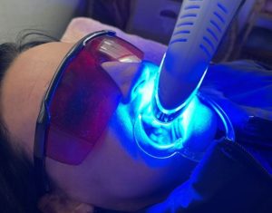 Inner Goddess Salon | Laser Teeth Whitening Session Incl A  Goddess Maintenance Kit For 1