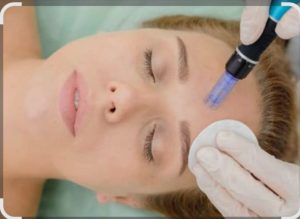 Nurture YourSelf | 60-Minute Face Microneedling for 1  At The Radisson Gautrain Blu Hotel